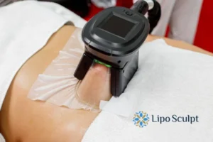 Cryolipolysis Helping You Getting that Perfect Summer Body 3 Cryolipolysis Ruislip can give you the best summer body - contact us today!