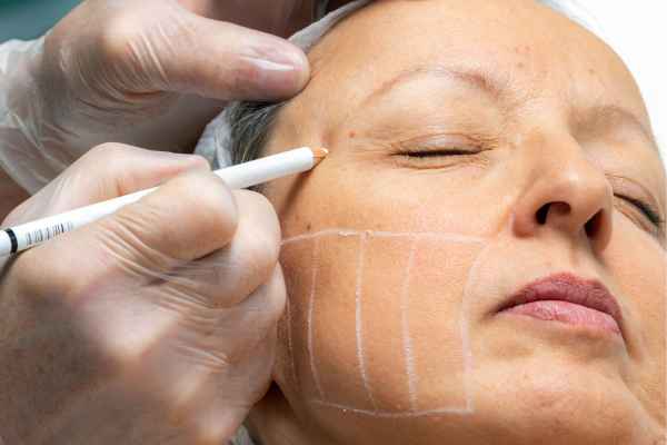 CryoPen: 5 Skin Concerns It May Be Used to Treat 4 What should you ask before having CryoPen treatment Ruislip?