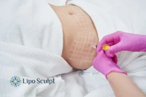 Are The Results From Aqualyx Permanent? 1 Do you want to know how long Aqualyx Ruislip results last?