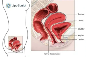Treatment For A Leaky Bladder 2 How EM Chair treatment Ruislip can help Leaky bladder issues. Read more now!