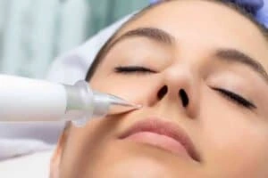 Best Actinic Keratoses Removal 3 Actinic keratoses Ruislip solutions - book in today!