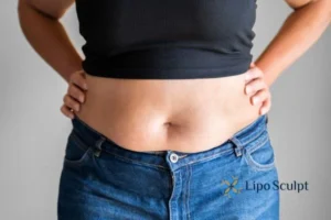 Bidding Farewell to Muffin Tops with Aqualyx Fat Injections 2 Do you wish you could reduce your muffin top Ruislip With Aqualy fat dissolving injections you can!