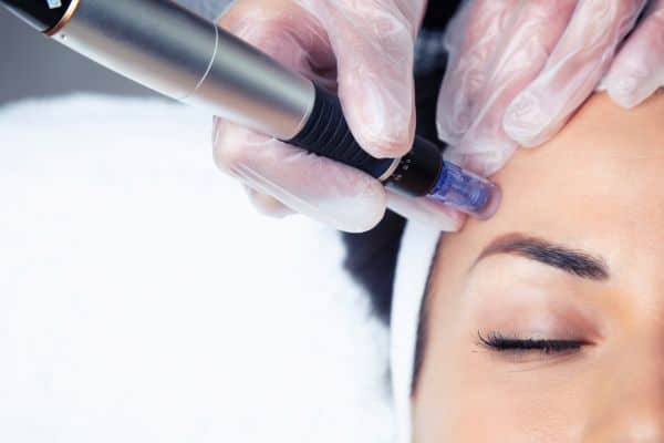 Explaining Total Skin Tightening Treatment and What to Expect 2 What Skin Concerns Can Total Skin Tightening Treatment Help With Ruislip?